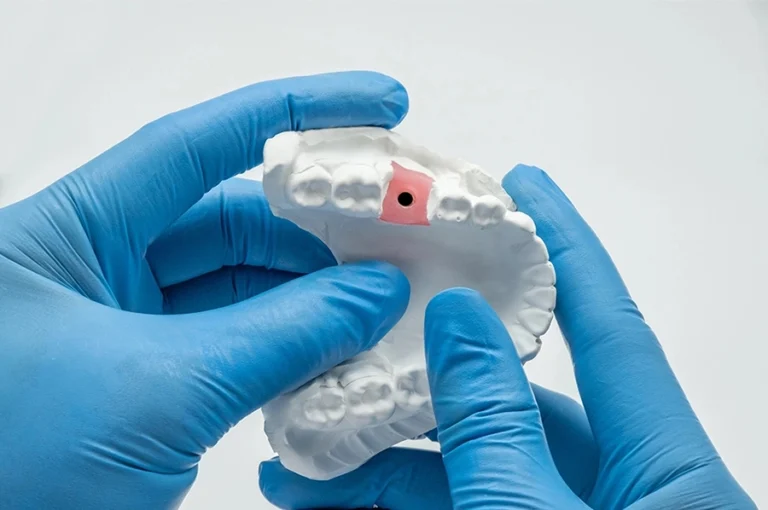 huge-artificial-gum-solution