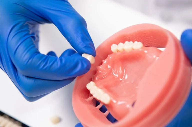 huge-digitalife-full-denture-solution