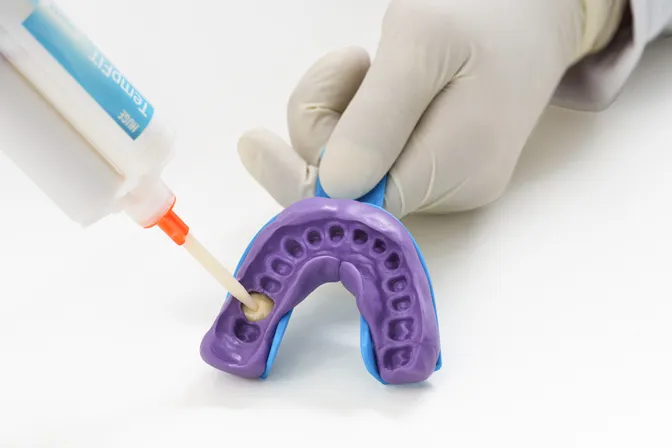 TempFIT Temporary Crown and Bridge Resin - Image 3
