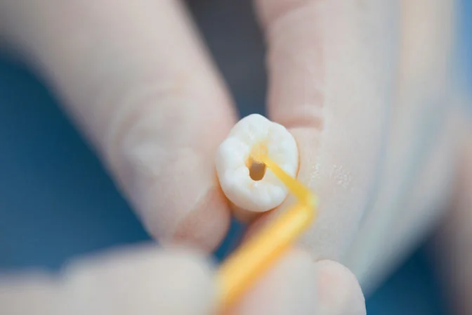 HugeBond Universal Light Cure Dental Adhesive - Image 3