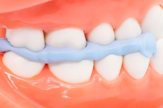 PERFIT Bite Registration-Normal Set - Image 3