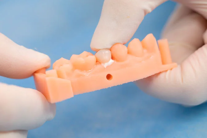 TopCEM-RMGI Resin Modified Glass Ionomer Cement-Luting - Image 2