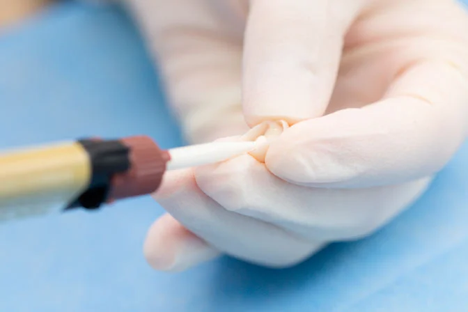 TopCEM-RMGI Resin Modified Glass Ionomer Cement-Luting - Image 3