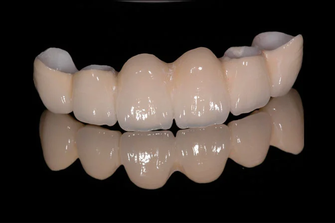 Prime High Translucency (HT) Zirconia Block - Image 4