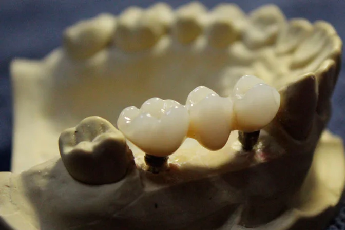 Prime Gradient Multilayer (GM-3D) Zirconia Block - Image 6