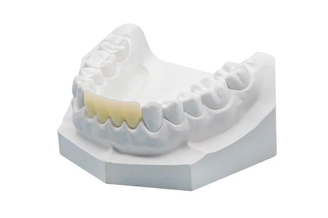 Premium High Translucency (HT) 100% Tosoh Material Zirconia Block - Image 4